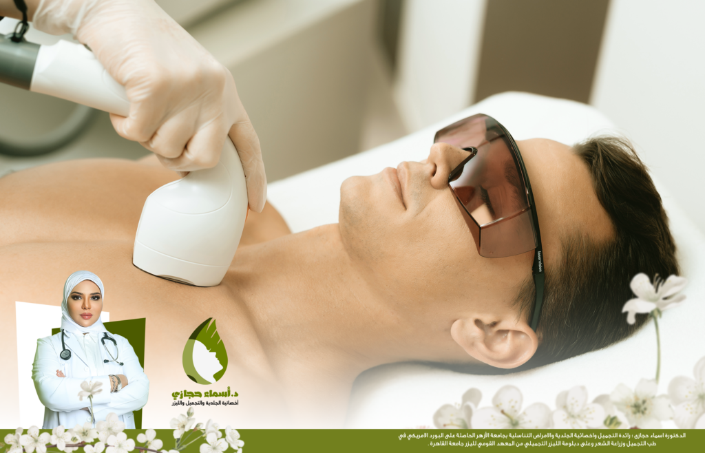إزالة الشعر بالليزر