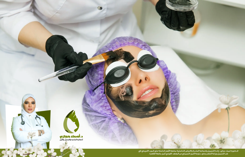 6 معلومات عن جلسات الليزر الكربوني للتصبغات يجب ان تعرفيها 2022 | الموقع الالكتروني للدكتورة اسماء حجازي الليزر الكربوني