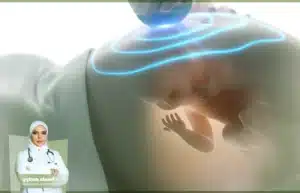إزالة الشعر بالليزر للحامل