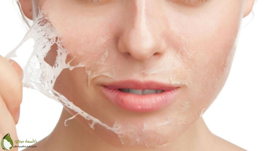 Chemical Peel At Home | الموقع الالكتروني للدكتورة اسماء حجازي التقشير البارد للوجه