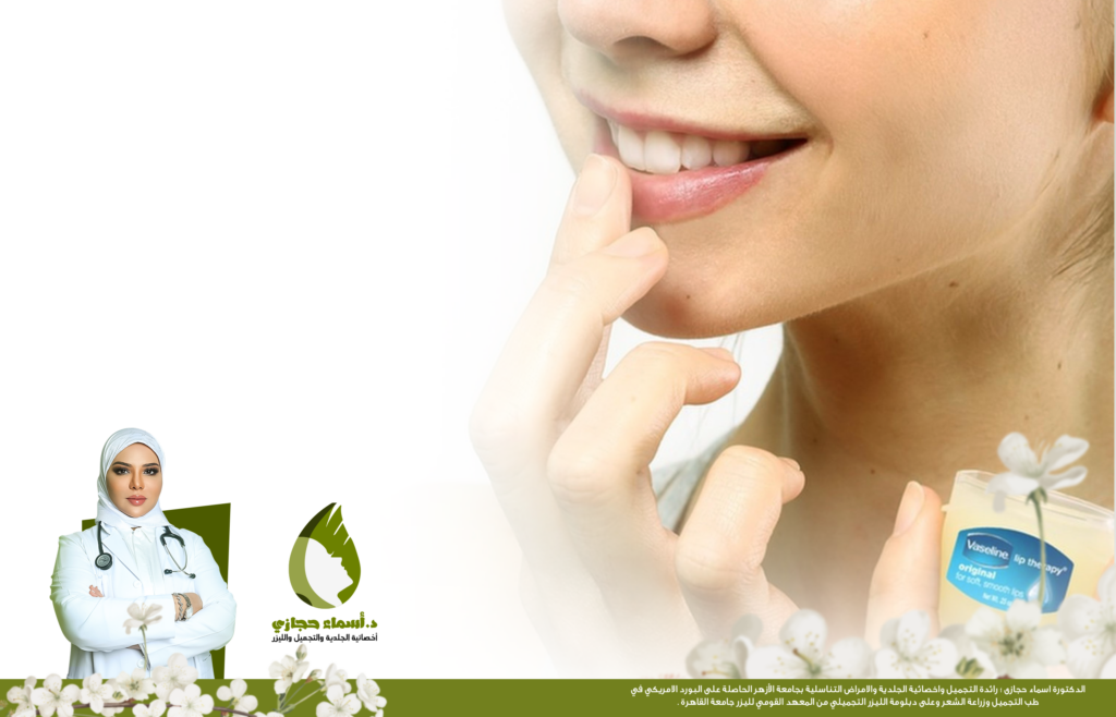 توريد الشفايف