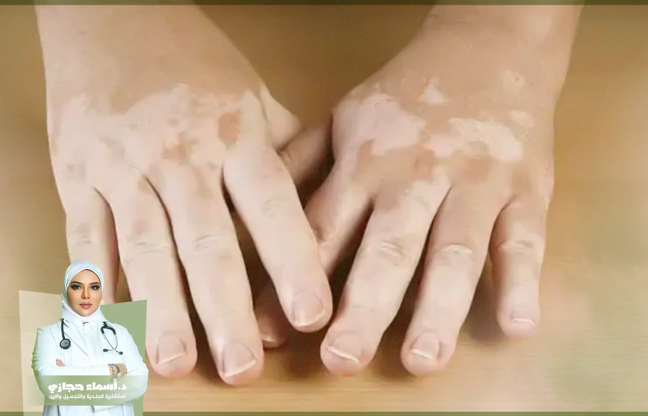 Jo 25 Aug 10 Artical 7 Copy 1 | الموقع الالكتروني للدكتورة اسماء حجازي أسرع علاج للبهاق