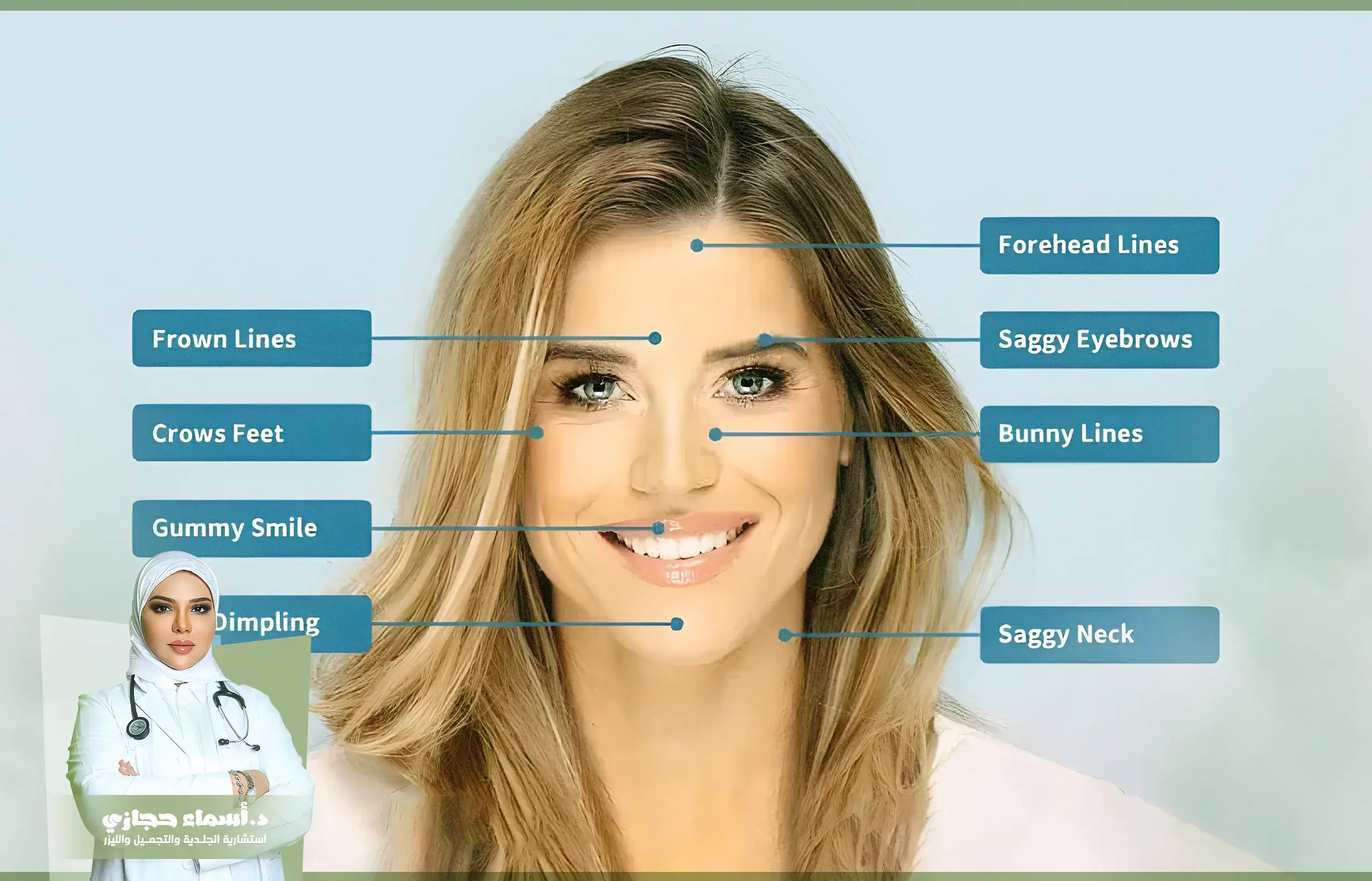 متى تبان نتيجة البوتكس