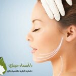 بوتكس نفرتيتي لتحديد الذقن والفك