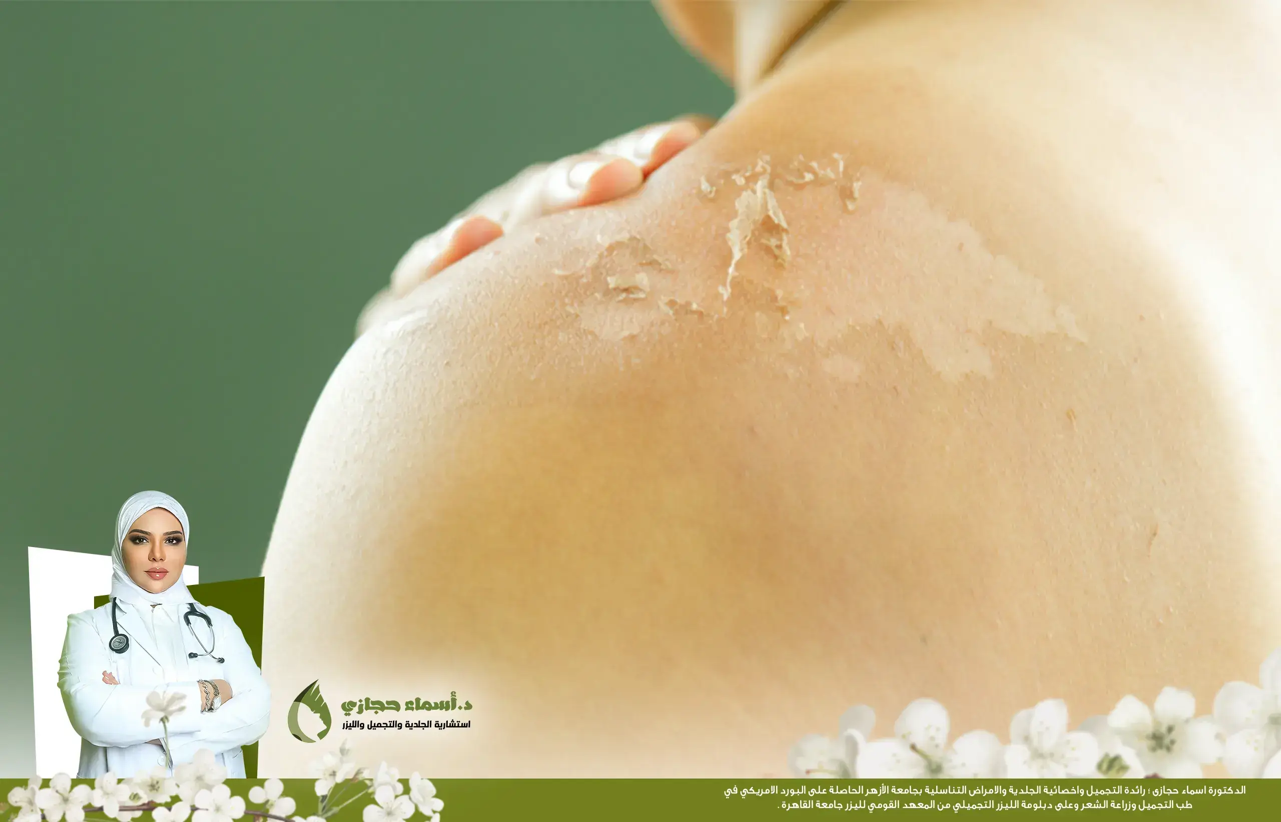 التقشير البارد للاندر ارم