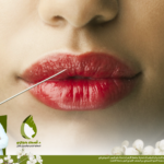 حقن Botox للشفايف