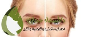الفيلر تحت العين | دكتور أسماء حجازى