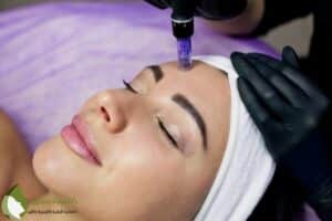 Beautician Makes Injections Into Forehead Mesotherapy With Microneedle Method 2 | دكتور أسماء حجازى