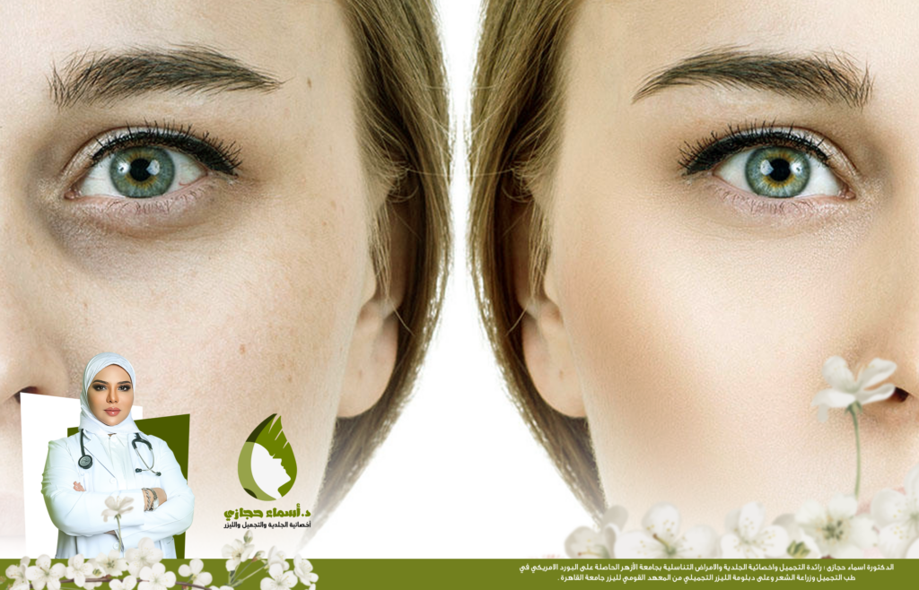 الخلايا الجذعية