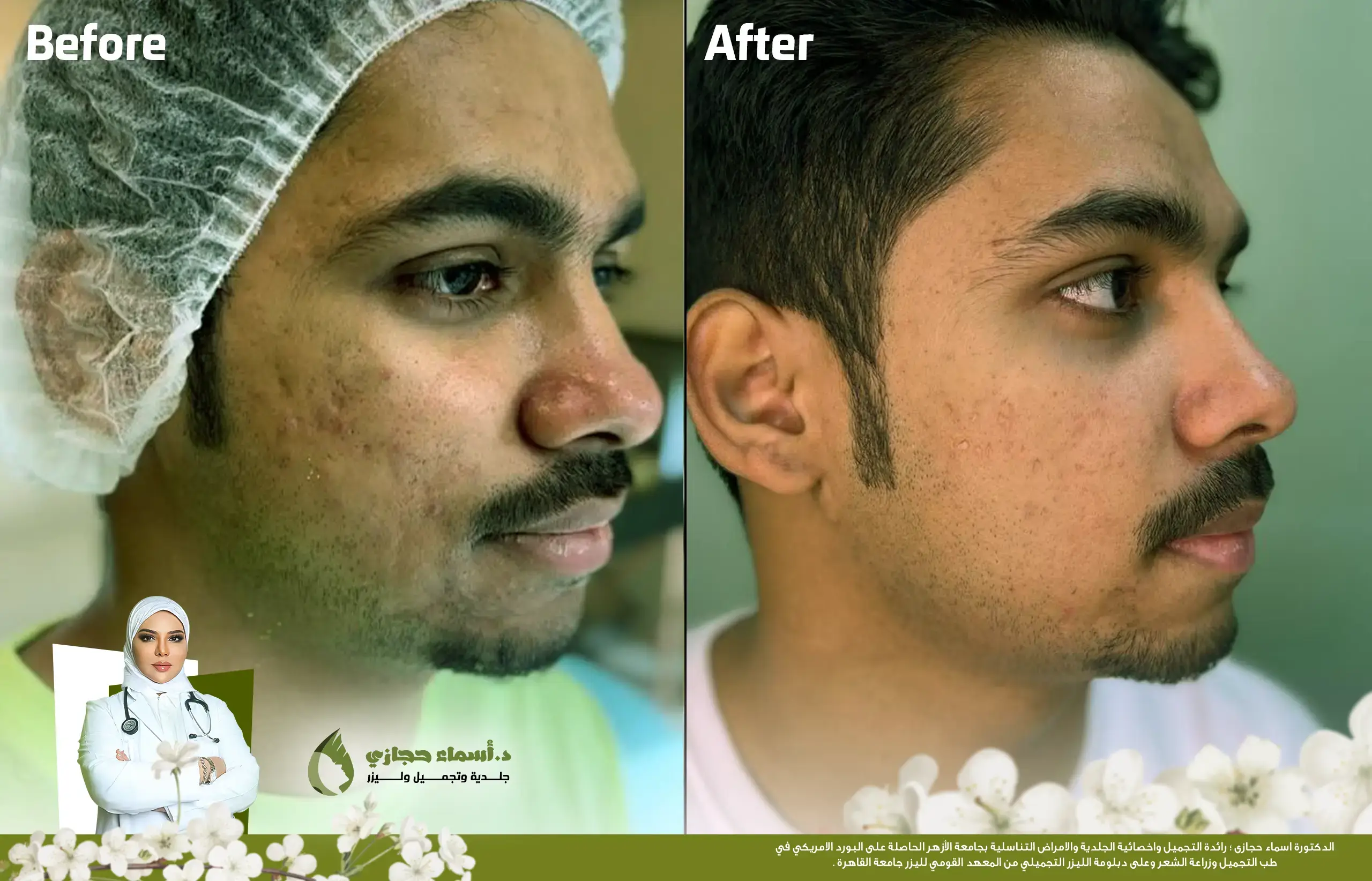 Jo 25 Mar 28 Frame Artical 02Copy | الموقع الالكتروني للدكتورة اسماء حجازي قطع الندبات