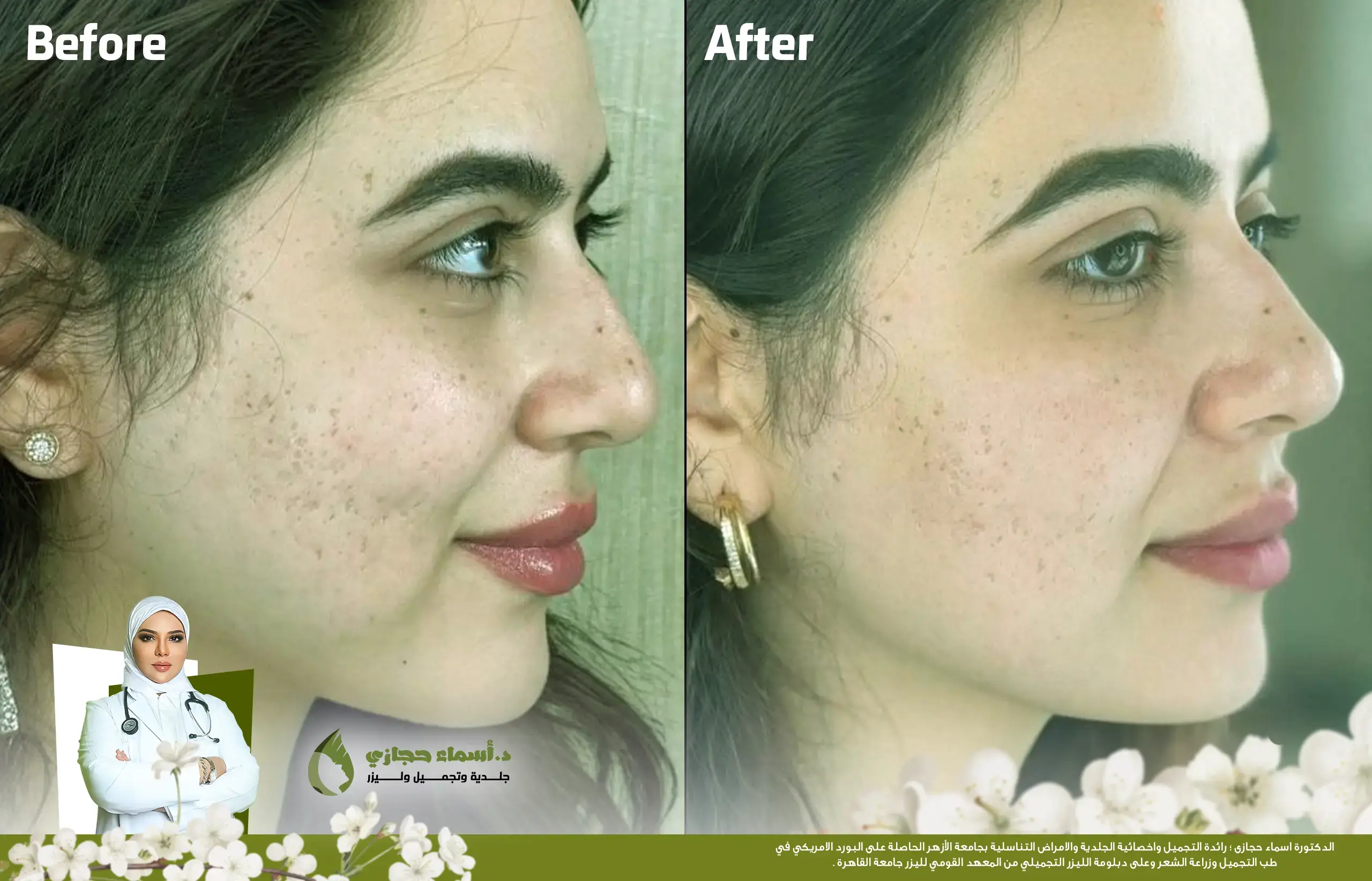 Jo 25 Mar 28 Frame Artical 03 Copy | الموقع الالكتروني للدكتورة اسماء حجازي قطع الندبات