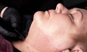 تقنية البلازماج