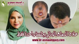 Maxresdefault 13 | دكتور أسماء حجازى
