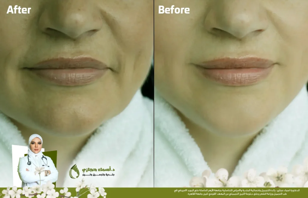 Jo 25 Apr 12 Frame Artical 03 Copy 1 | الموقع الالكتروني للدكتورة اسماء حجازي Jo 25 Apr 12 Frame Artical 03 Copy 1 | الموقع الالكتروني للدكتورة اسماء حجازي