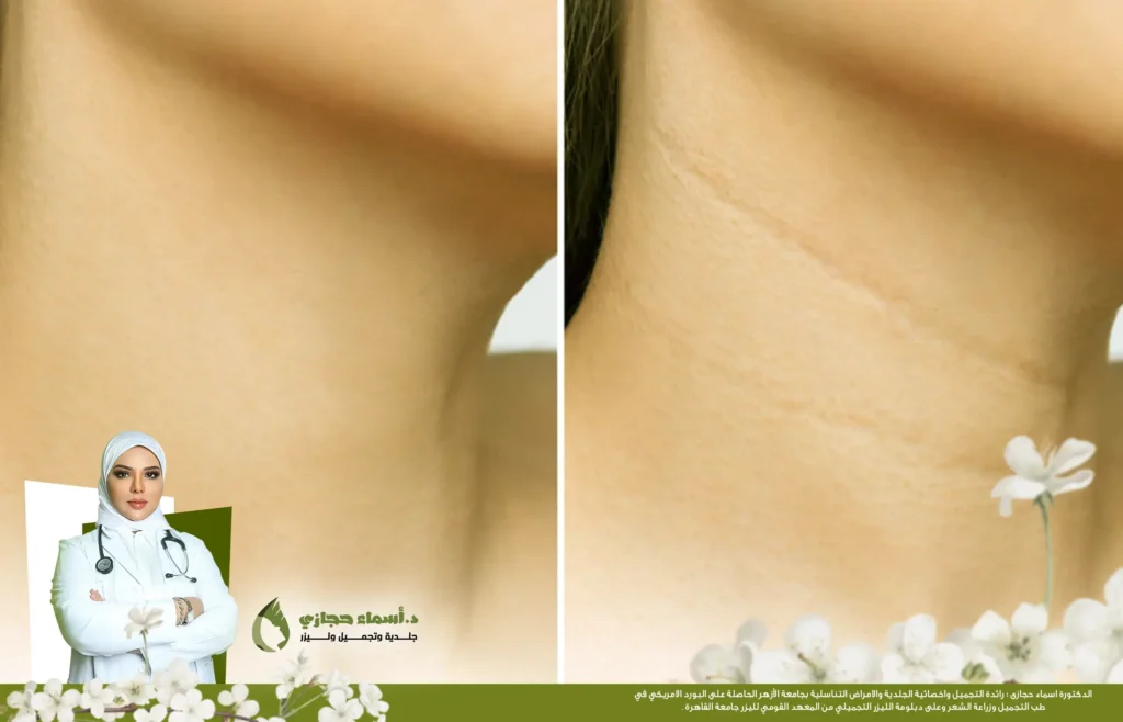 Jo 25 Mar 29 Frame Artical 5 Copy 1 | الموقع الالكتروني للدكتورة اسماء حجازي خطوط الرقبة