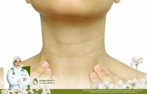 خطوط الرقبة