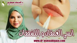 Maxresdefault 18 | دكتور أسماء حجازى