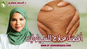Maxresdefault 20 | دكتور أسماء حجازى