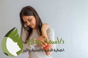 علاج للصدفية مجرب2 | دكتور أسماء حجازى