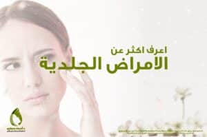 اكثر عن الامراض الجلدية دكتورة اسماء حجازي | دكتور أسماء حجازى