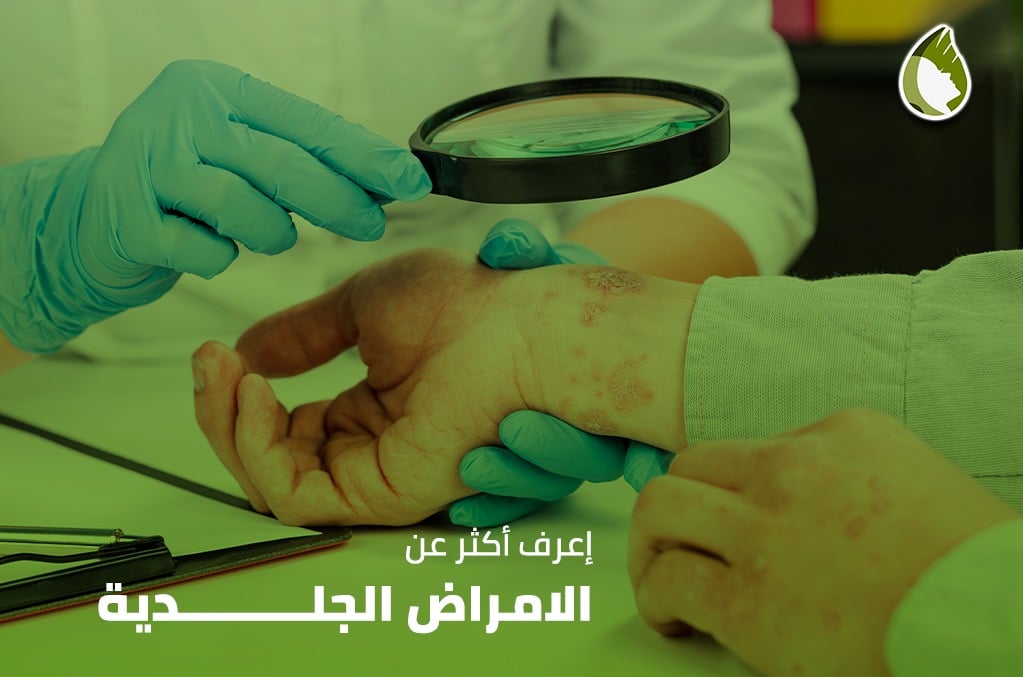 اكثر عن الامراض الجلدية | دكتور أسماء حجازى