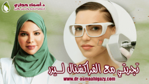 مع الفركشنال ليزر لعلاج ندبات حب الشباب | دكتور أسماء حجازى