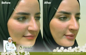 Jo 25 Apr 08 Frame Artical 02 1 | الموقع الالكتروني للدكتورة اسماء حجازي