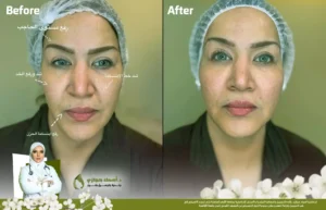 Jo 25 Apr 08 Frame Artical 03 1 | الموقع الالكتروني للدكتورة اسماء حجازي