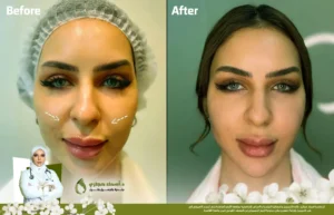 Jo 25 Apr 08 Frame Artical 04 1 | الموقع الالكتروني للدكتورة اسماء حجازي