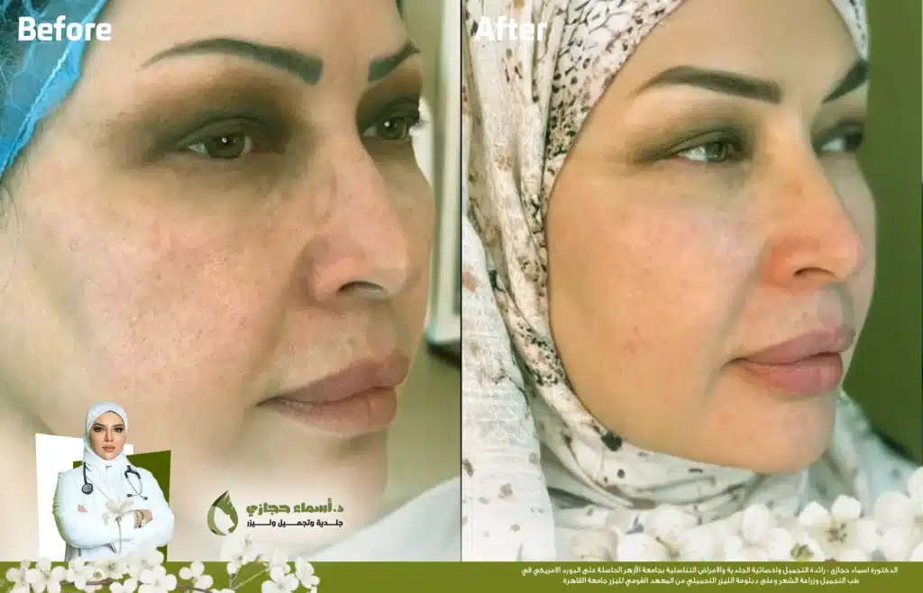 Jo 25 Mar 28 Frame Artical 01 Copy | الموقع الالكتروني للدكتورة اسماء حجازي مورفيوس 8