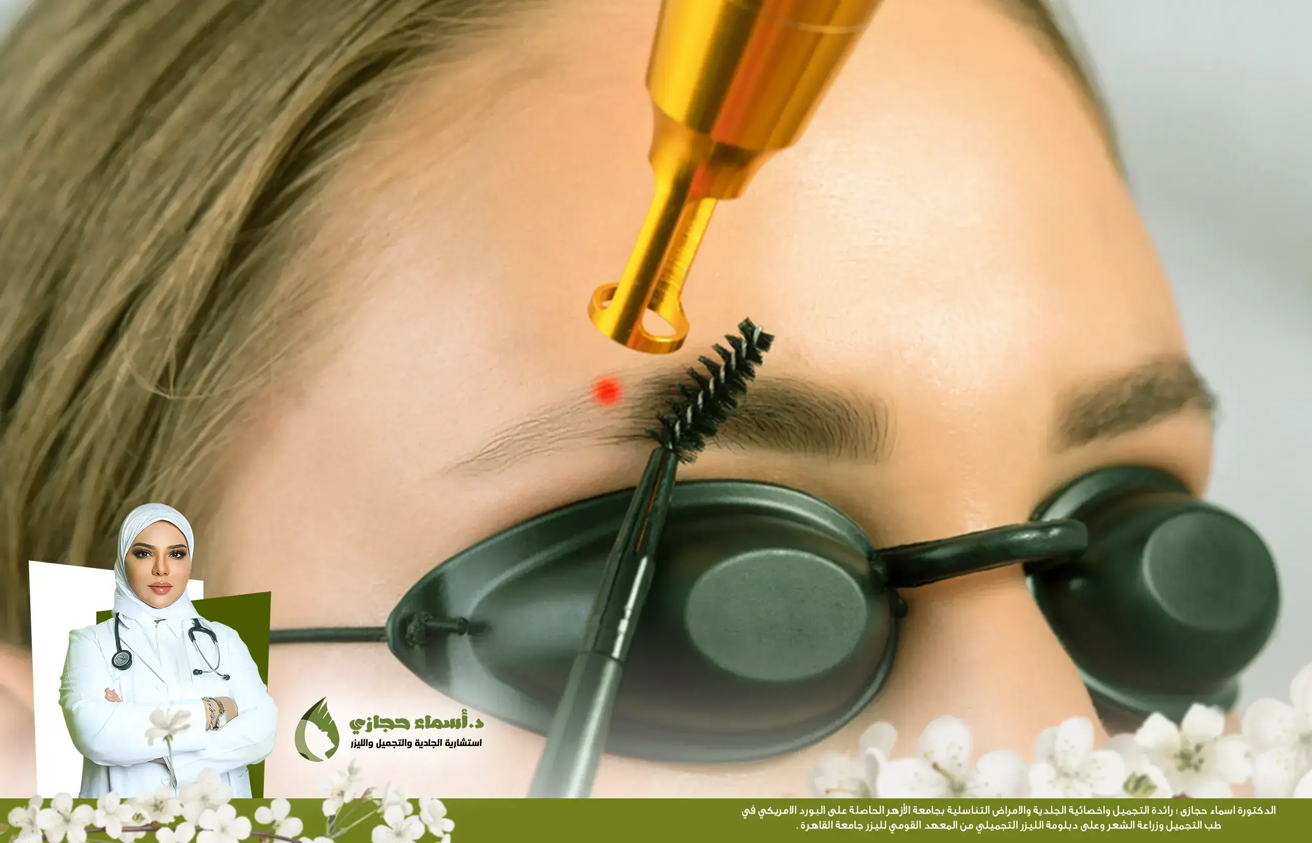 إزالة التاتو بالليزر