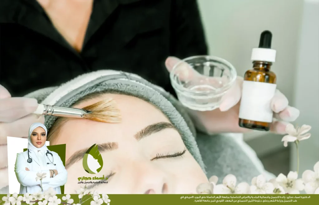 نصائح بعد التقشير البارد