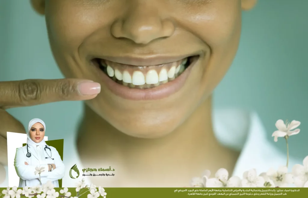 علاج الأبتسامة اللثوية