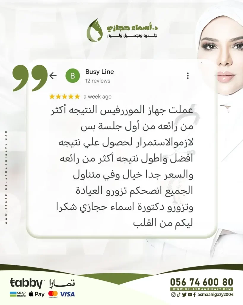 المورفيس للوجه