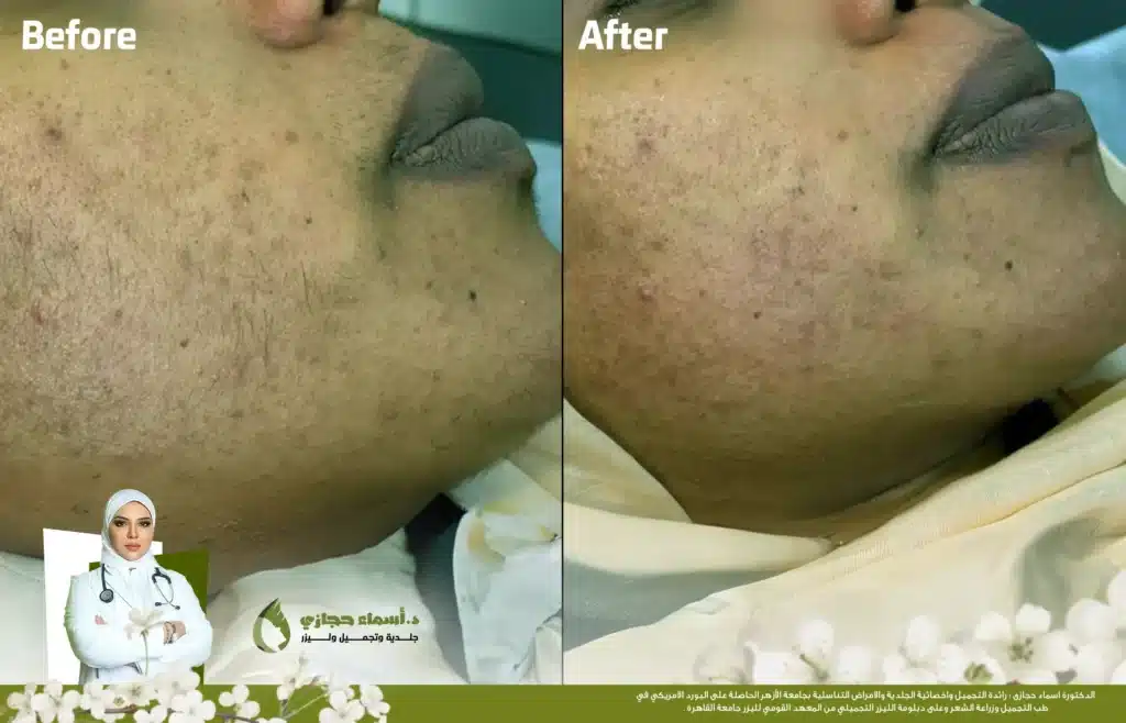 Jo 25 Mar 28 Frame Artical 12 Copy 1 | الموقع الالكتروني للدكتورة اسماء حجازي Jo 25 Mar 28 Frame Artical 12 Copy 1 | الموقع الالكتروني للدكتورة اسماء حجازي