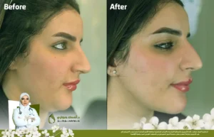 فينوس لاجاسي