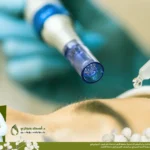 سيروم بعد الديرما بن