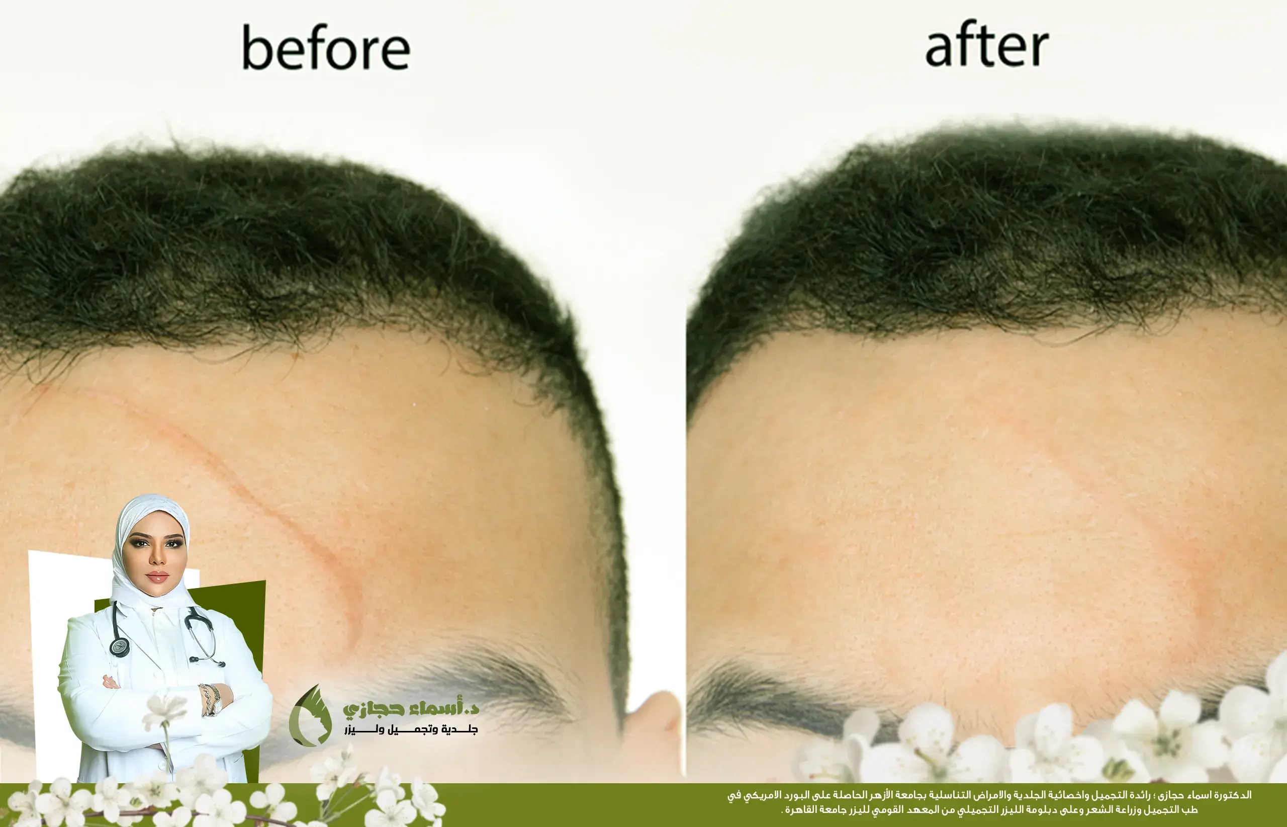 Jo 25 Apr 20 Frame Artical 3 Copy | الموقع الالكتروني للدكتورة اسماء حجازي فراكشنال ليزر