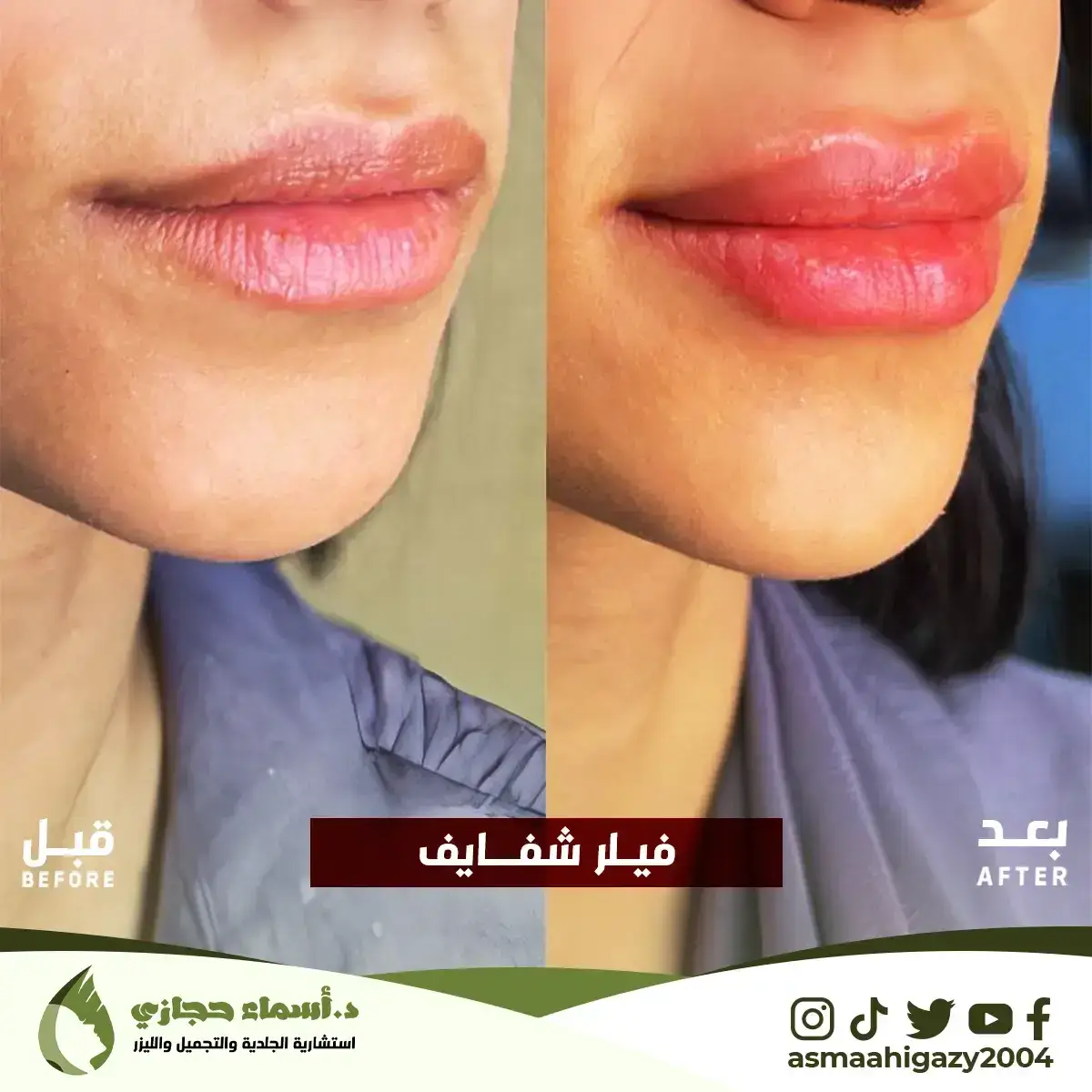 Jo-25-Apr-23-B&Amp;A-Filler-1 Copy