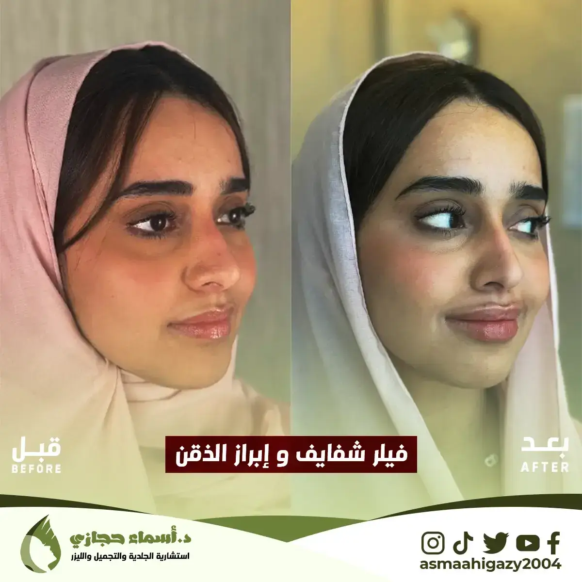 Jo-25-Apr-23-B&Amp;A-Filler-10 Copy