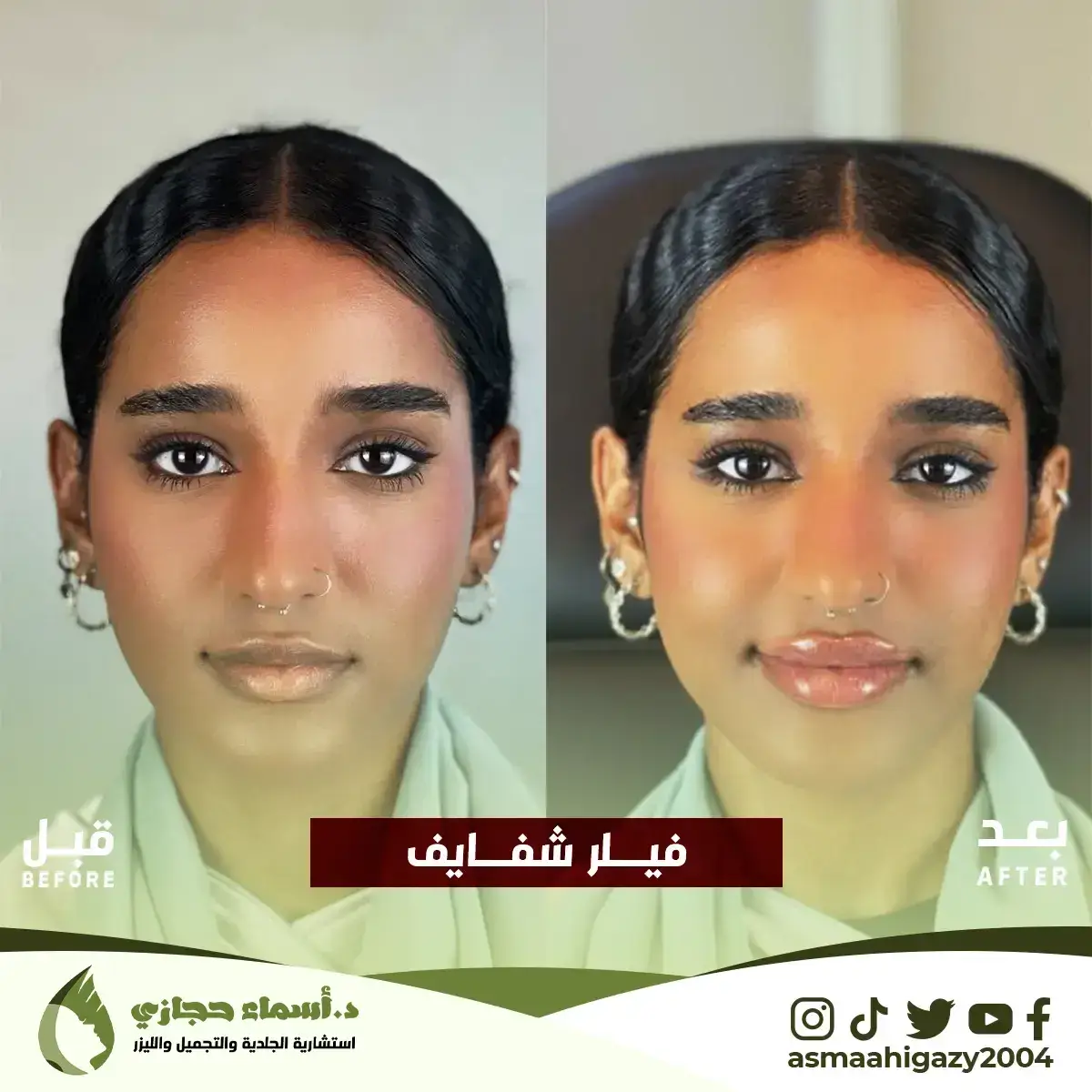 Jo-25-Apr-23-B&Amp;A-Filler-11 Copy