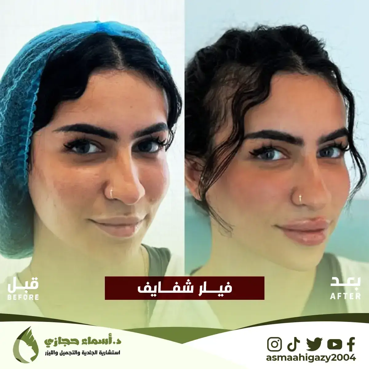 Jo-25-Apr-23-B&Amp;A-Filler-12 Copy