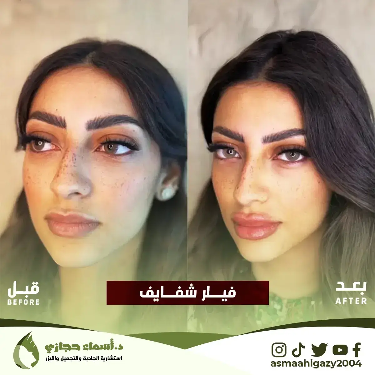 Jo-25-Apr-23-B&Amp;A-Filler-13 Copy