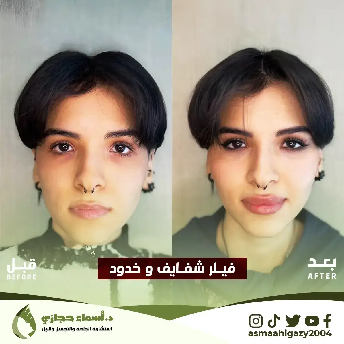 Jo-25-Apr-23-B&Amp;A-Filler-14 Copy