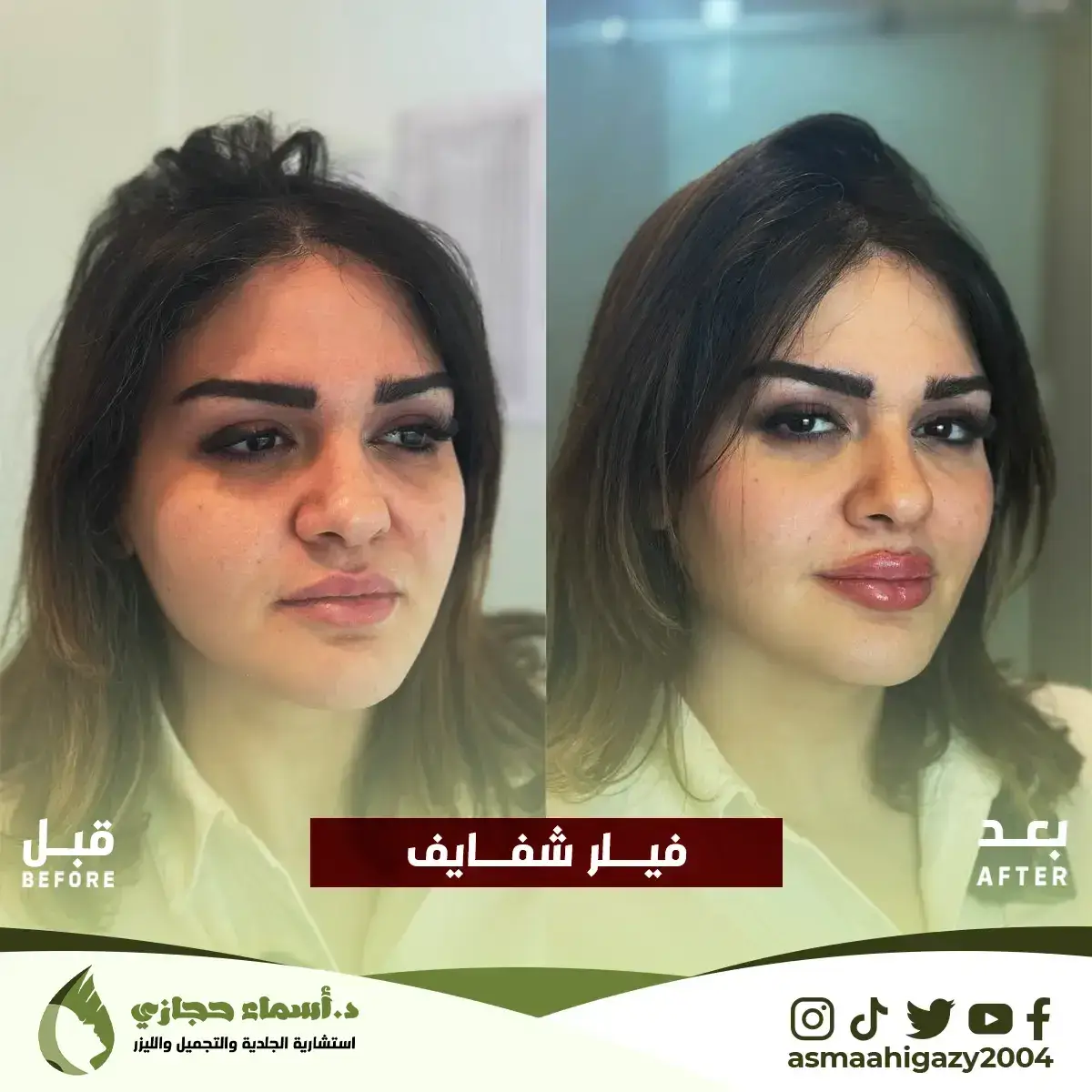 Jo-25-Apr-23-B&Amp;A-Filler-15 Copy