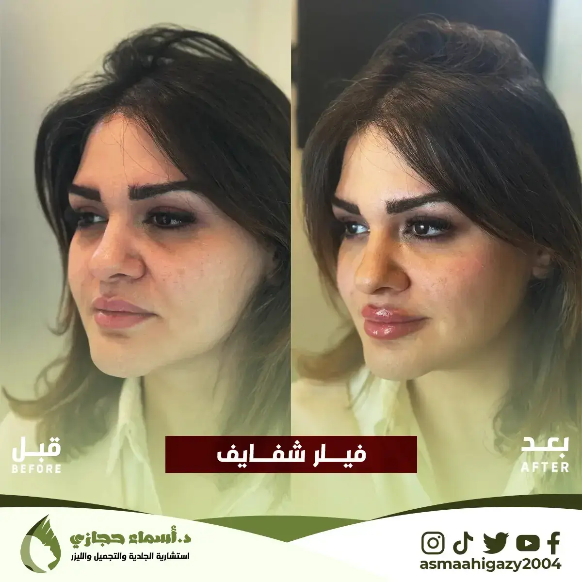 Jo-25-Apr-23-B&Amp;A-Filler-16 Copy