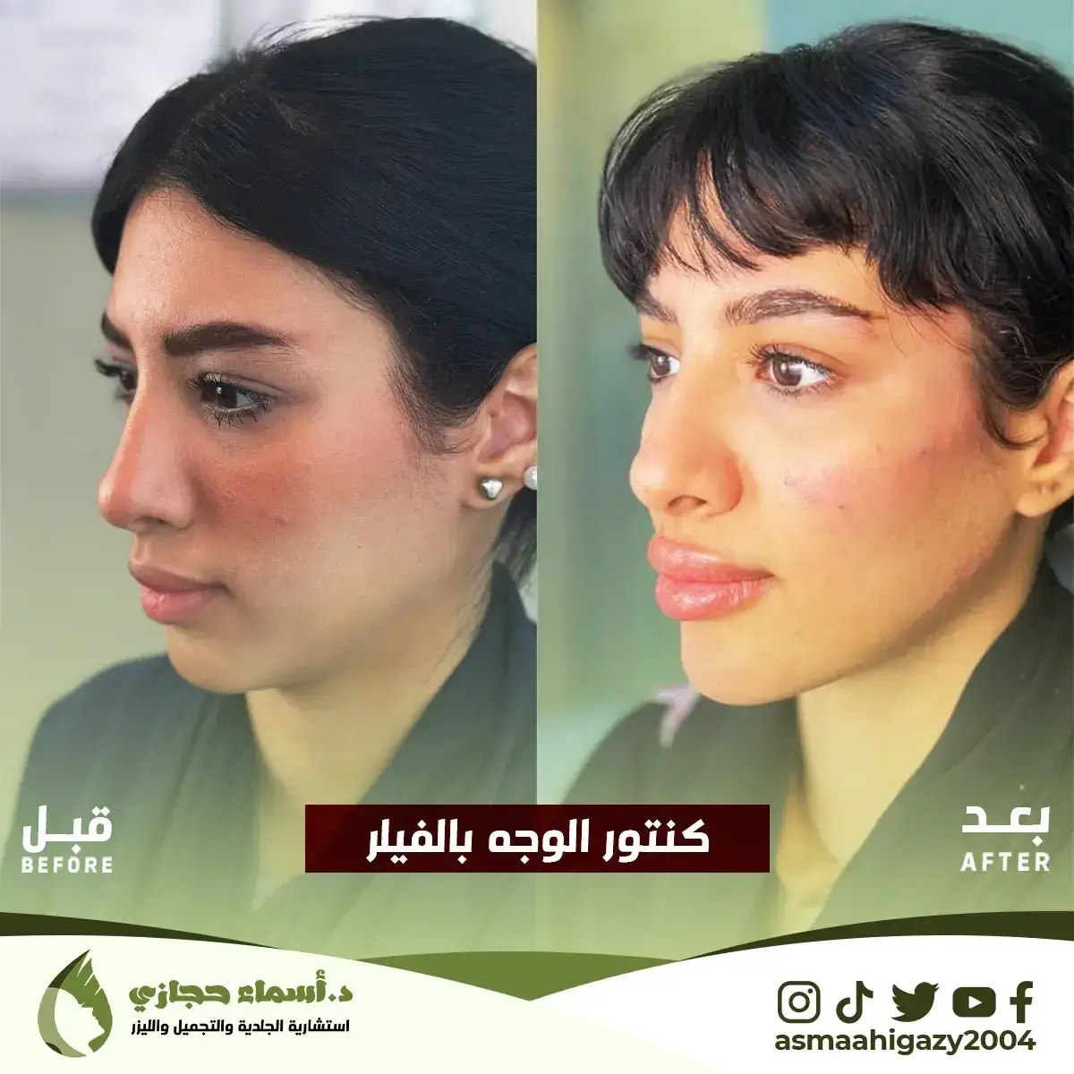 Jo-25-Apr-23-B&Amp;A-Filler-18 Copy