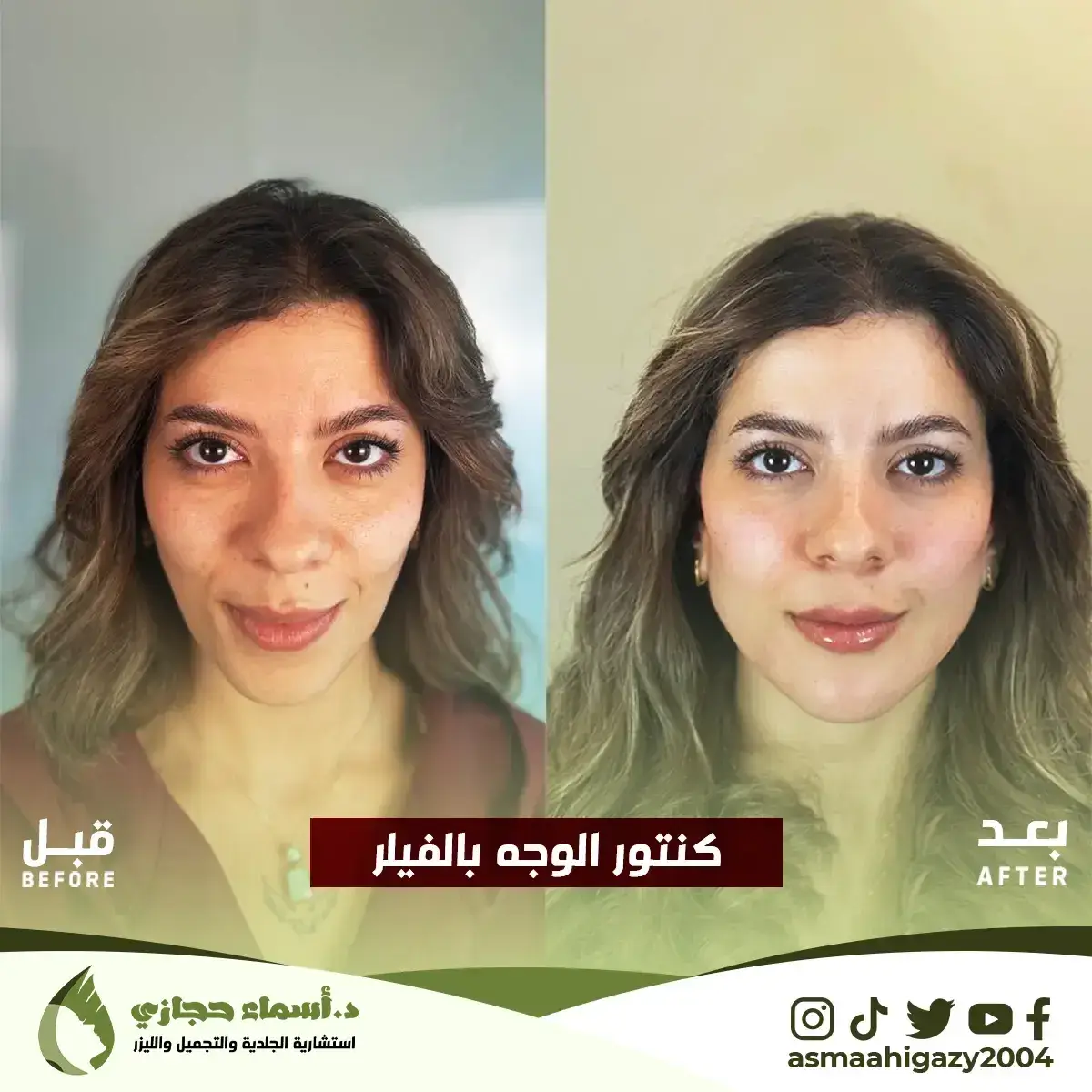 Jo-25-Apr-23-B&Amp;A-Filler-19 Copy