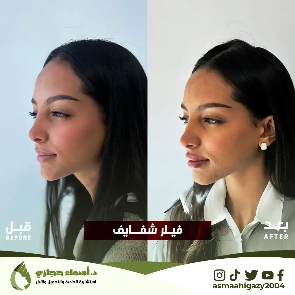 Jo-25-Apr-23-B&Amp;A-Filler-2 Copy