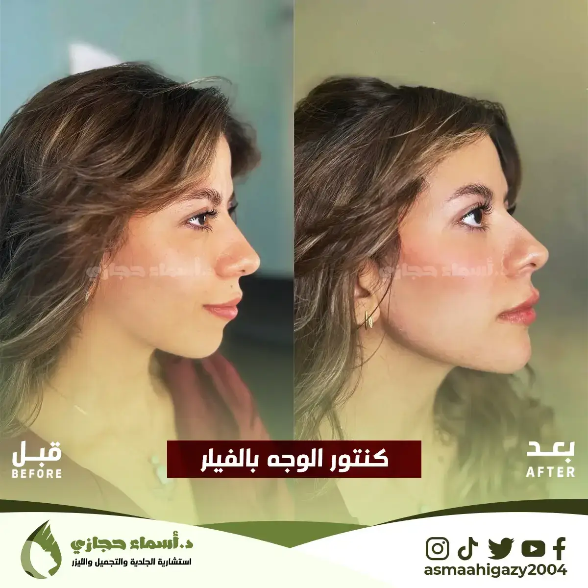 Jo-25-Apr-23-B&Amp;A-Filler-20 Copy